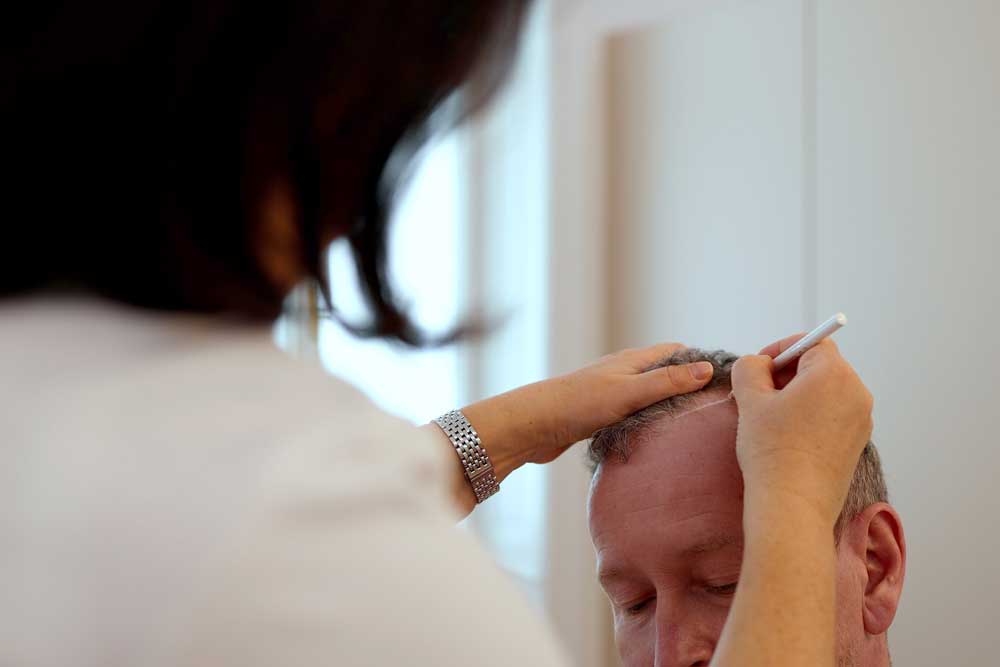 haardesign-mit-dhi Bild zeigt Implanter